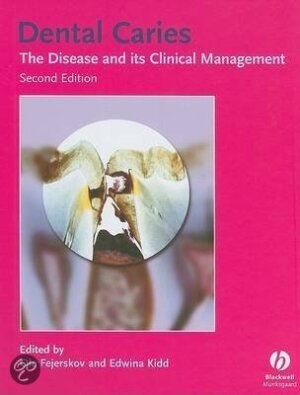 Dental Caries The Disease and its Clinical Management