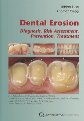 Dental erosion diagnosis, risk assessment, prevention and treatment