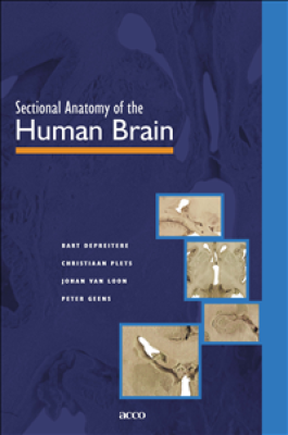 Sectional Anatomy of the Human Brain