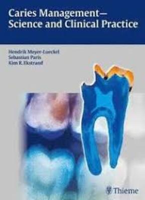 Cariesmanagement: Science and Clinical Practice