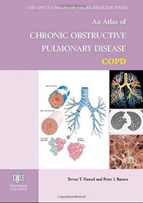 An Atlas of Chronic Obstructive Pulmonary Disease COPD