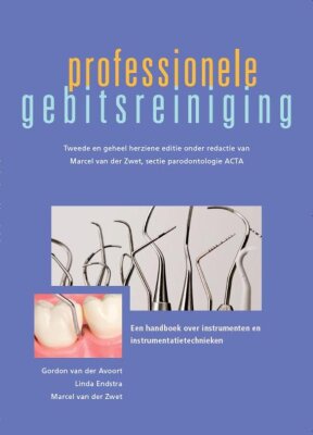 professionele gebitsreiniging