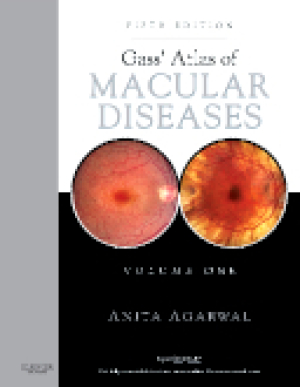 Gass' Atlas of Macular Diseases