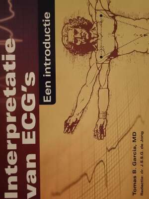 Interpretatie van ECG's